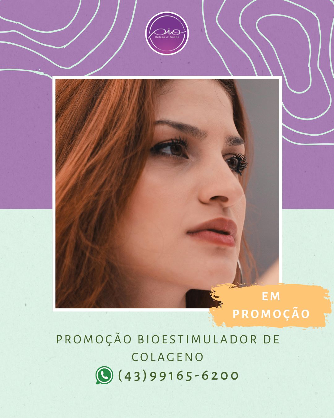 Bioestimulador de colageno